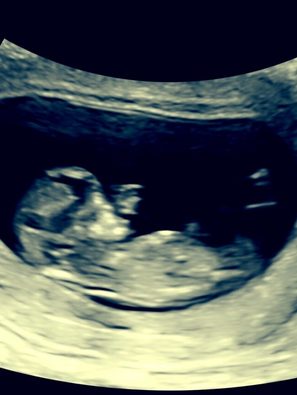 Pregnancy Announcement Gradient Graphic - ITS A GIRL 🩷